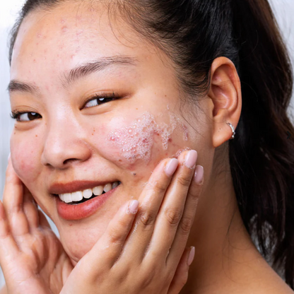 SVR - Gel Moussant sebiaclear